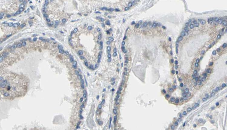 CALR / Calreticulin Antibody