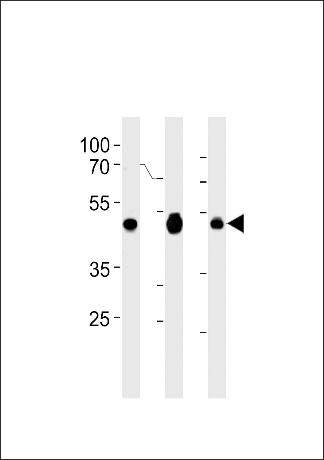 Polyclonal Rabbit anti-Human PA2G4 / EBP1 Antibody (aa228-255, IHC, WB)