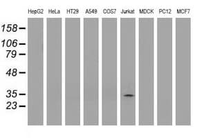 P5CR2 / PYCR2 Antibody (clone OTI5C7)