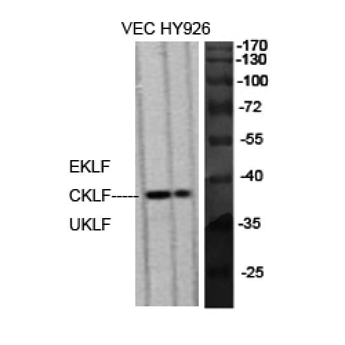 EKLF / KLF1 Antibody (280-360 aa, C-terminal)