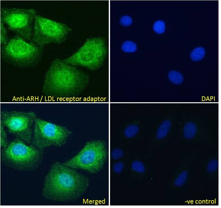 Polyclonal Goat anti-Human ARH / LDLRAP1 Antibody (aa2-14, IF)