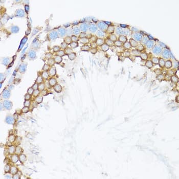 CTNNA1 / Catenin Alpha-1 Antibody