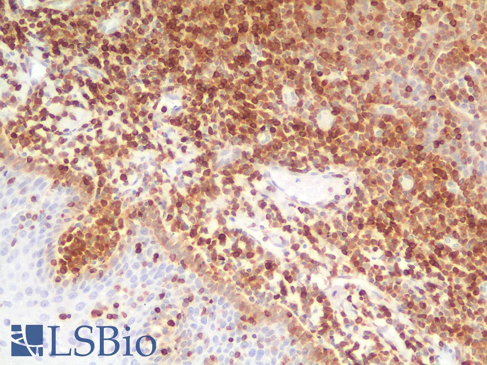 PathPlus™ BCL2 / Bcl-2 Antibody (clone rBCL2/796)