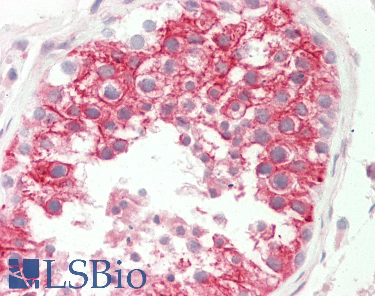 IHC-plus™ GOK / STIM1 Antibody (C-Terminus)