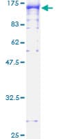 Human MPS1 / TTK Protein (Recombinant GST)