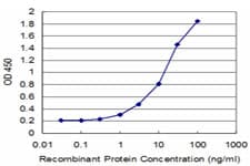 USP14 Antibody (clone 1F8)