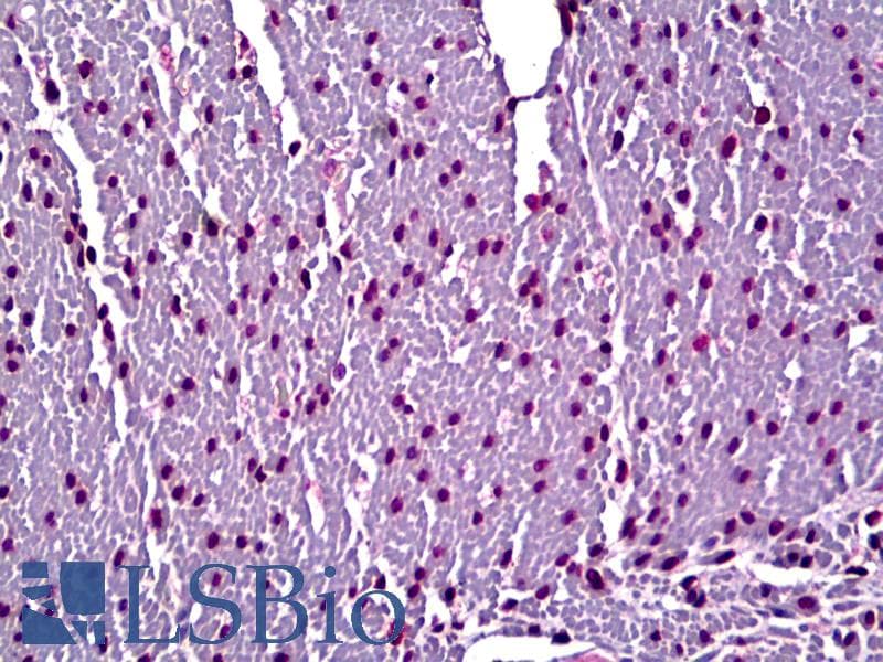 IHC-plus™ Monoclonal Mouse anti-Human Myosin, Cardiac Heavy Chain Antibody (IHC, IF, WB)