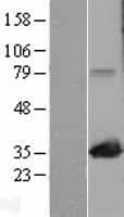 MAPRE1 / EB1 Protein (Over-Expression Lysate Myc-DDK (Flag))