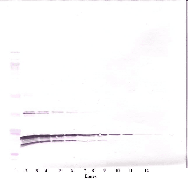 Polyclonal Rabbit anti-Human LTA / TNF Beta Antibody (WB)
