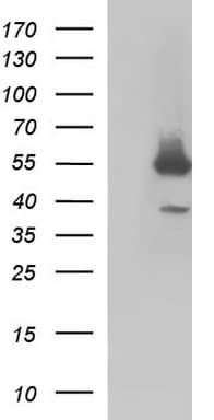 FGG / Fibrinogen Gamma Antibody (clone OTI1D1, Carrier-free)