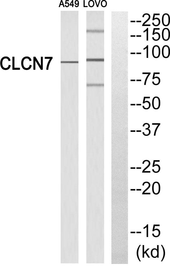 CLC-7 / CLCN7 Antibody