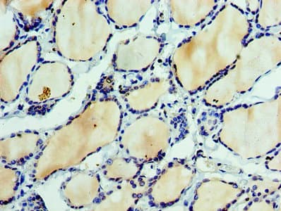 EFNA3 / Ephrin A3 Antibody (aa23-214)