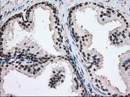 H6PD / G6PDH Antibody (clone OTI2A7)