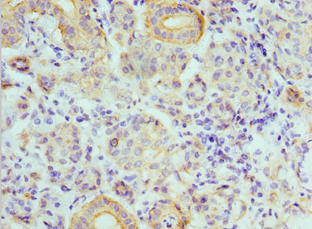IHC-plus™ ATP6V1B1 Antibody (aa1-280)