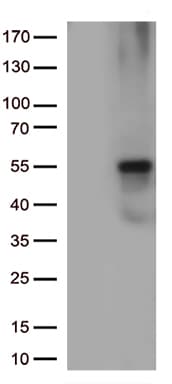KRT8 / CK8 / Cytokeratin 8 Antibody (aa91-381, clone OTI2F5)