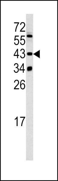 Polyclonal Rabbit anti-Human SETD8 / SET8 Antibody (aa220-249, IHC, WB)