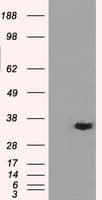 Monoclonal Mouse anti-Human AKR1A1 Antibody (clone OTI9F1, IHC, WB)
