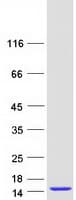 Human CKS1B / CKS1 Protein (Recombinant Myc-DDK (Flag))