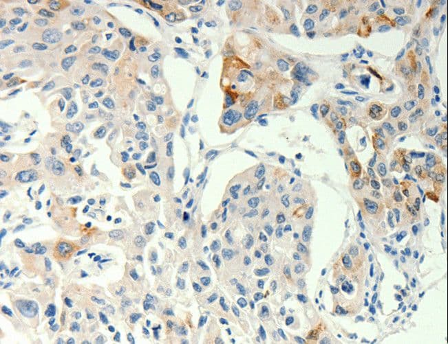 TRPA1 Antibody