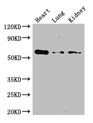 Polyclonal Rabbit anti-Human GCGR / Glucagon Receptor Antibody (aa26-136, IHC, IF, WB)