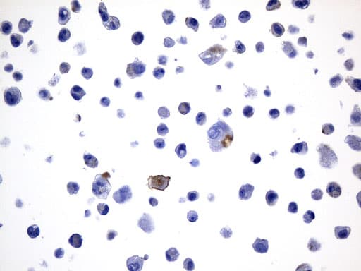 CD274 / B7-H1 / PD-L1 Antibody (aa19-290, clone UMAB229)