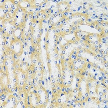CAMK1 / CAMKI Antibody