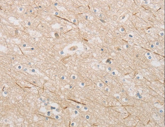 ZWINT Antibody