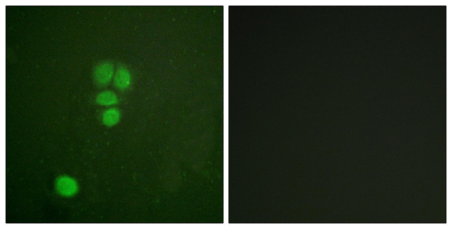 Polyclonal Rabbit anti-Human SOX9 Antibody (p181, IHC, IF, WB)