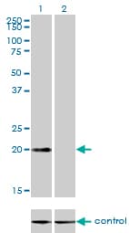 Monoclonal Mouse anti-Human CSRP3 Antibody (clone 6D2, IF, WB)