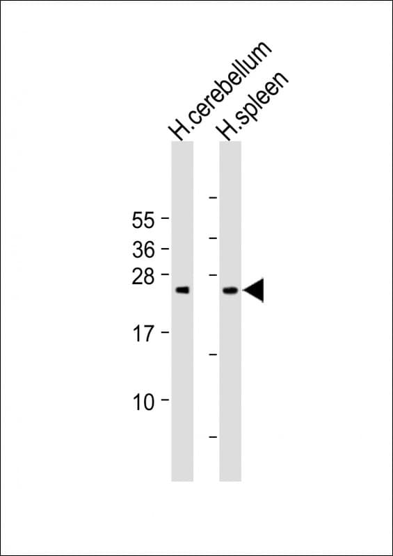 GCL / Grancalcin Antibody (N-Terminus)