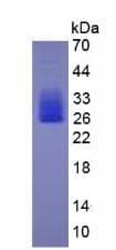 Mouse IL6 / Interleukin 6 Protein (Recombinant His, N-Terminal)