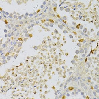 Polyclonal Rabbit anti-Human PFK2 / PFKFB3 Antibody (IHC)