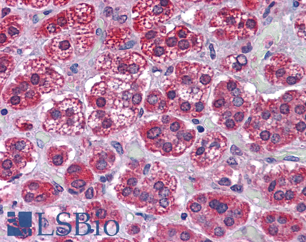 IHC-plus™ Polyclonal Goat anti-Human KPNA6 Antibody (aa74-87, IHC, WB)