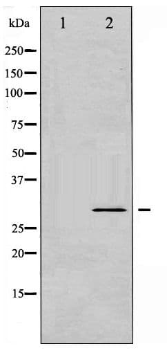 Polyclonal Rabbit anti-Human BCL2L1 / BCL-XL Antibody (phospho-Ser62, IHC, WB)