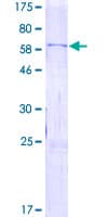 Human WIF1 Protein (Recombinant GST)