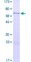 Human ADAMTSL4 Protein (Recombinant GST)