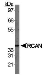 RCAN1 / DSCR1 Antibody (aa210-252)