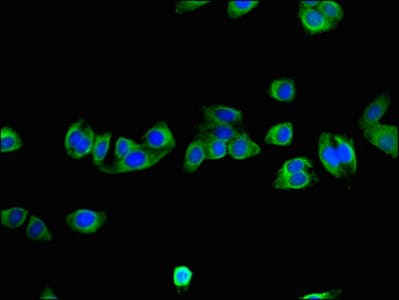 NNMT Antibody