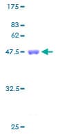 Human CIRP / CIRBP Protein (Recombinant GST)