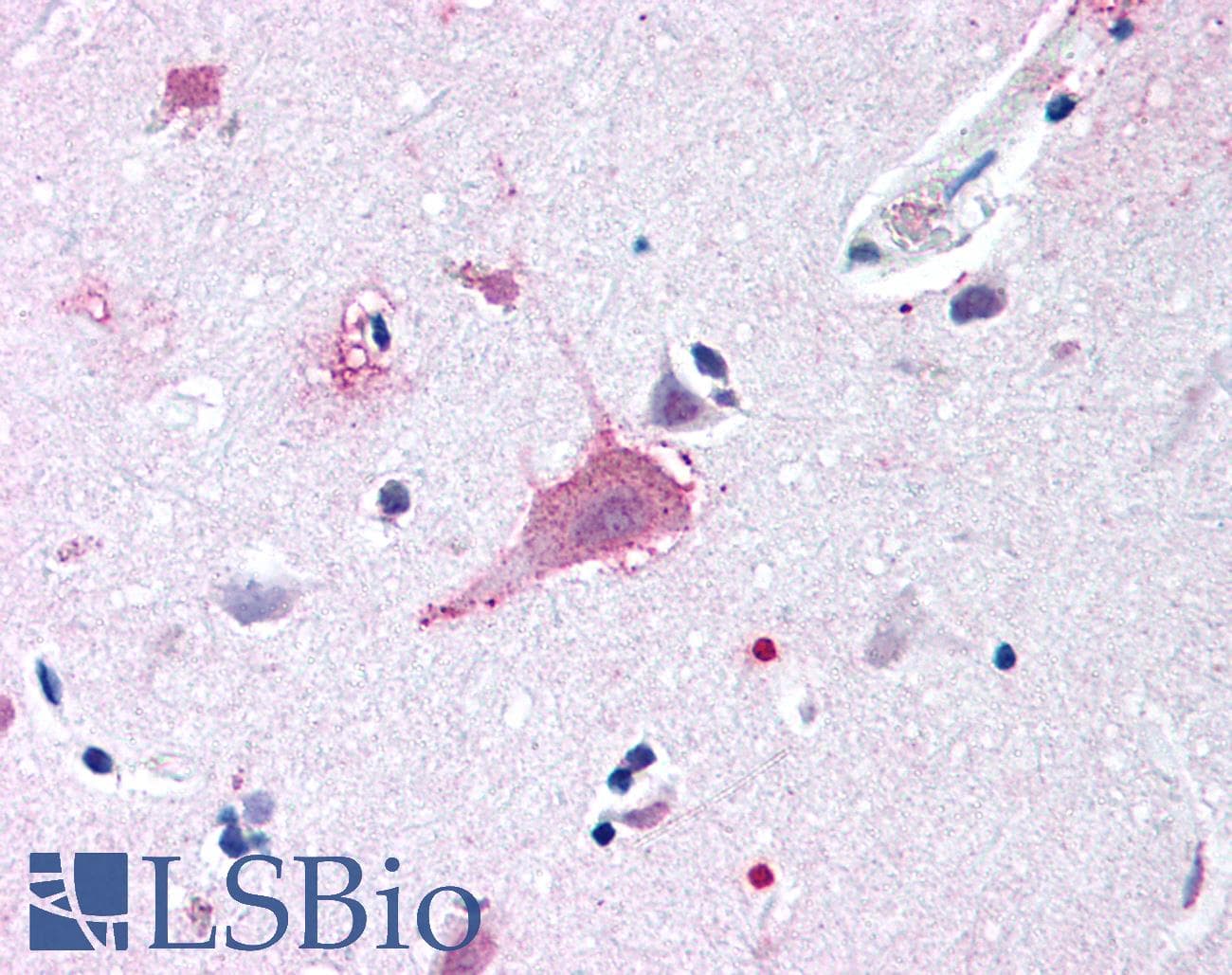 IHC-plus™ Polyclonal Rabbit anti-Human FZD9 / Frizzled 9 Antibody (N-Terminus, IHC)