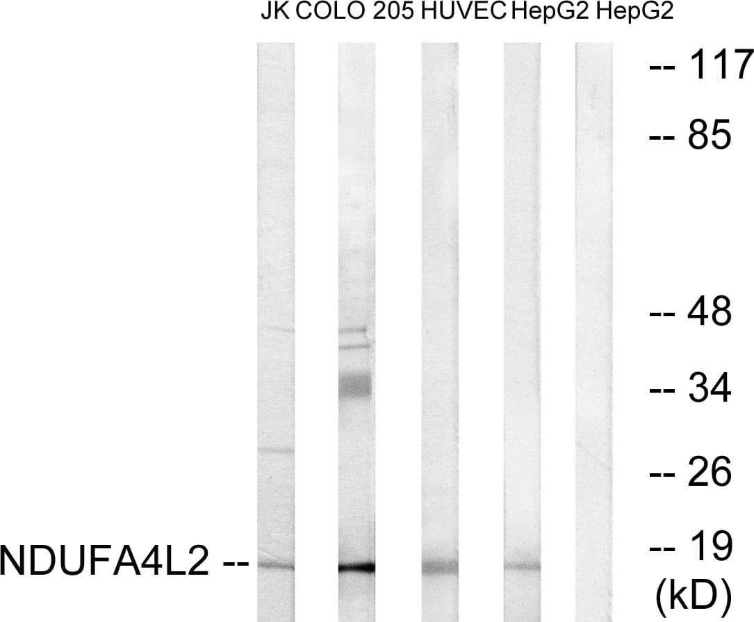 IHC-plus™ NDUFA4L2 Antibody (aa38-87)