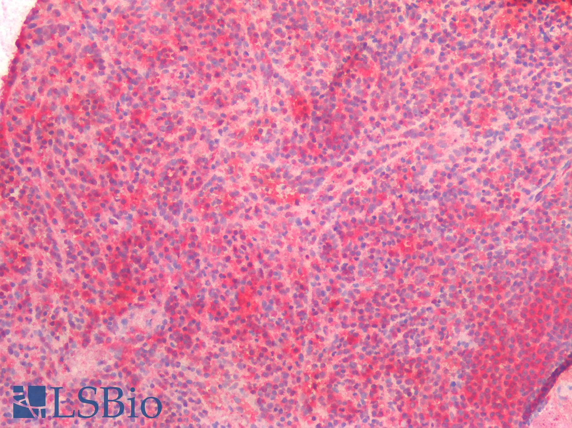 IHC-plus™ Polyclonal Rabbit anti-Human BCL2L1 / BCL-XL Antibody (aa46-66, IHC, WB)