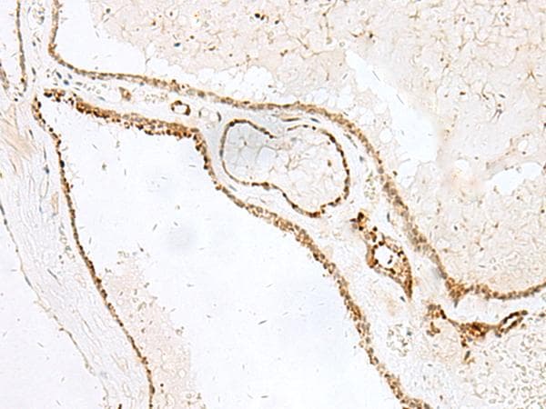 GSKIP / C14orf129 Antibody