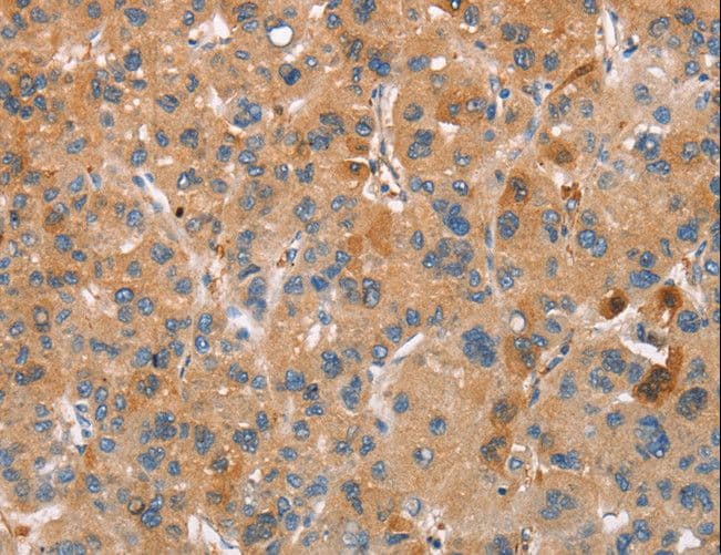 PLIN2 / ADFP / Adipophilin Antibody