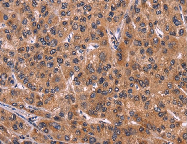 Polyclonal Rabbit anti-Human ART5 Antibody (IHC)