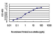 Monoclonal Mouse anti-Human PAK1 Antibody (clone 4D1, IF, WB)