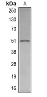 SETD6 Antibody