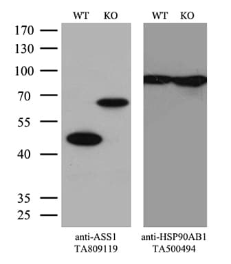 Monoclonal Mouse anti-Human ASS1 / ASS Antibody (clone OTI1B10, Carrier-free, C-Terminus, WB)