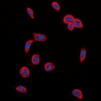 Polyclonal Rabbit anti-Human KDR / VEGFR2 / FLK1 Antibody (C-Terminus, IHC, IF, WB)