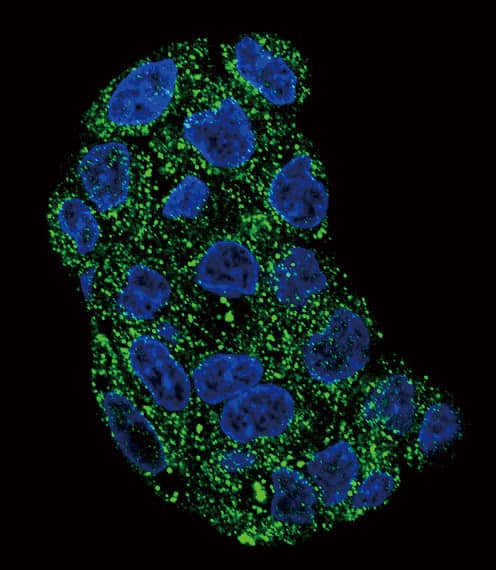IHC-plus™ Polyclonal Rabbit anti-Human GPX1 / Glutathione Peroxidase Antibody (aa164-193, IHC, IF, WB)
